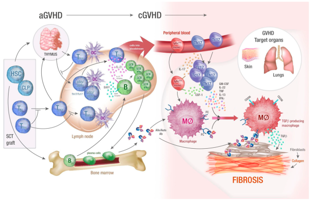 بیماری پیوند در مقابل میزبان (GVHD)