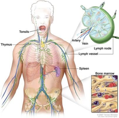 Hodgkin's lymphoma & Non-Hodgkin's lymphoma