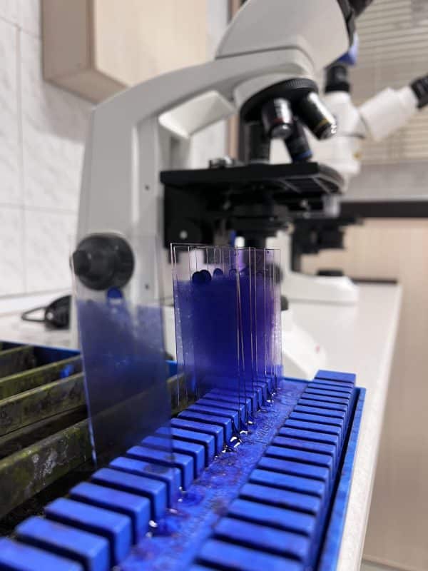 Peyvand Laboratory Bone marrow transplant laboratory آسپیراسیون